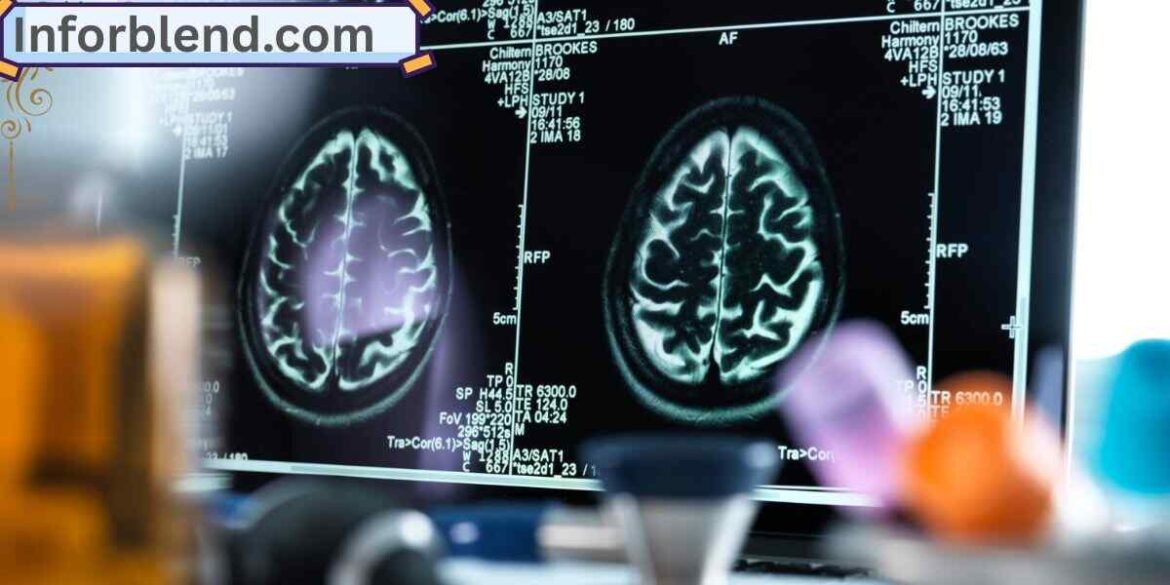 “MRI scan of a human brain showing highlighted areas indicating possible microbleeds.”